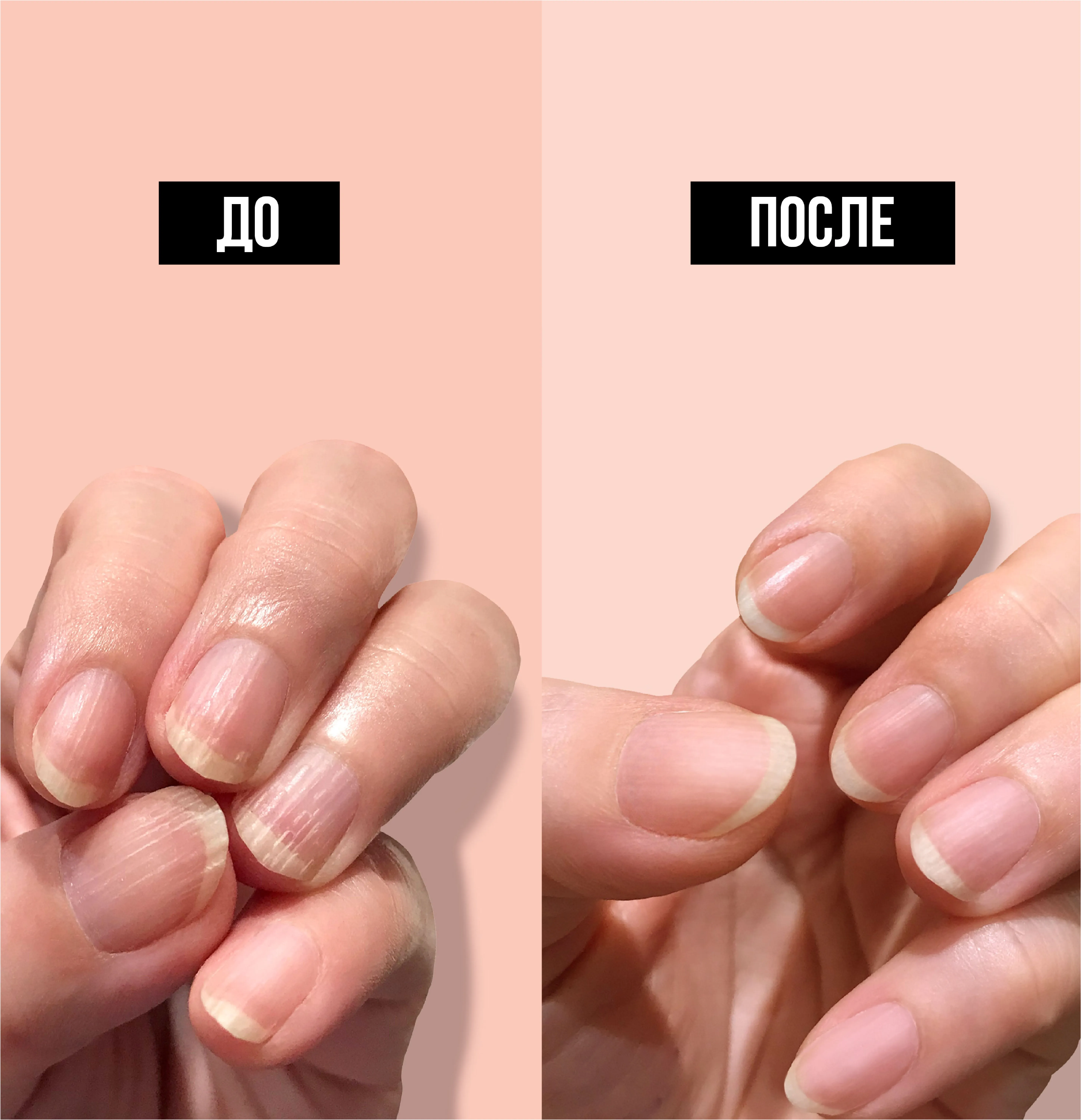 kur Выравнивающее базовое покрытие, 12мл